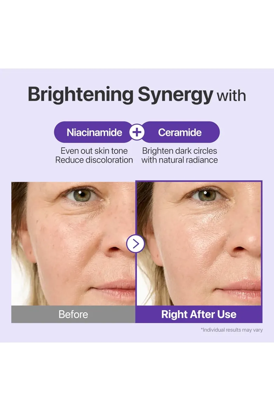 کرم دور چشم رتینال +NAD شماره ۹ ضد چروک روشن کننده و حاوی پپتید نامبوزین Numbuzin No.9 NAD+ Retinal Eye Cream مناسب چه کسانی است؟